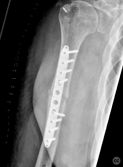 case image