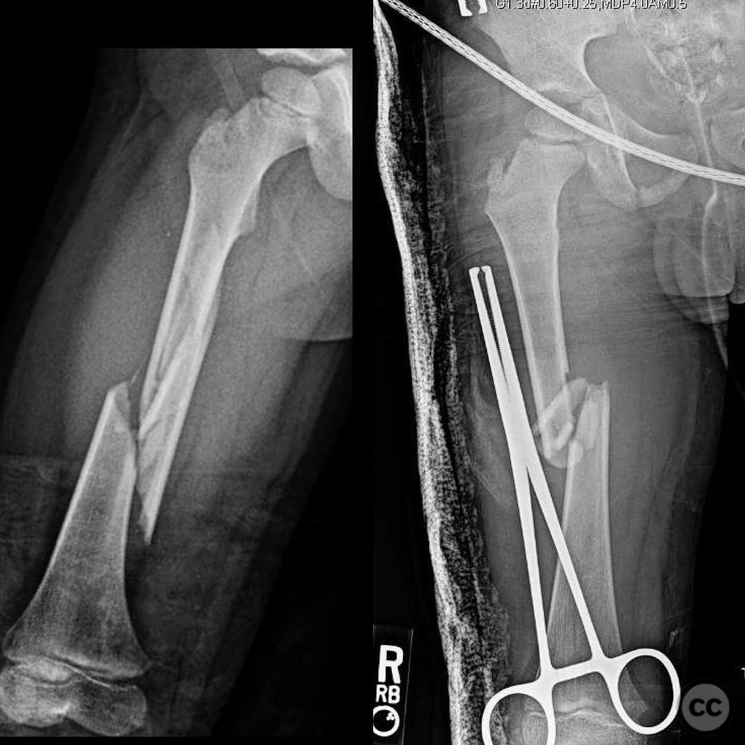 case image