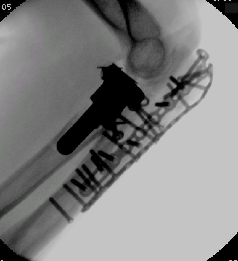 case image