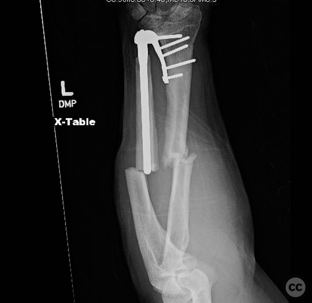 case image