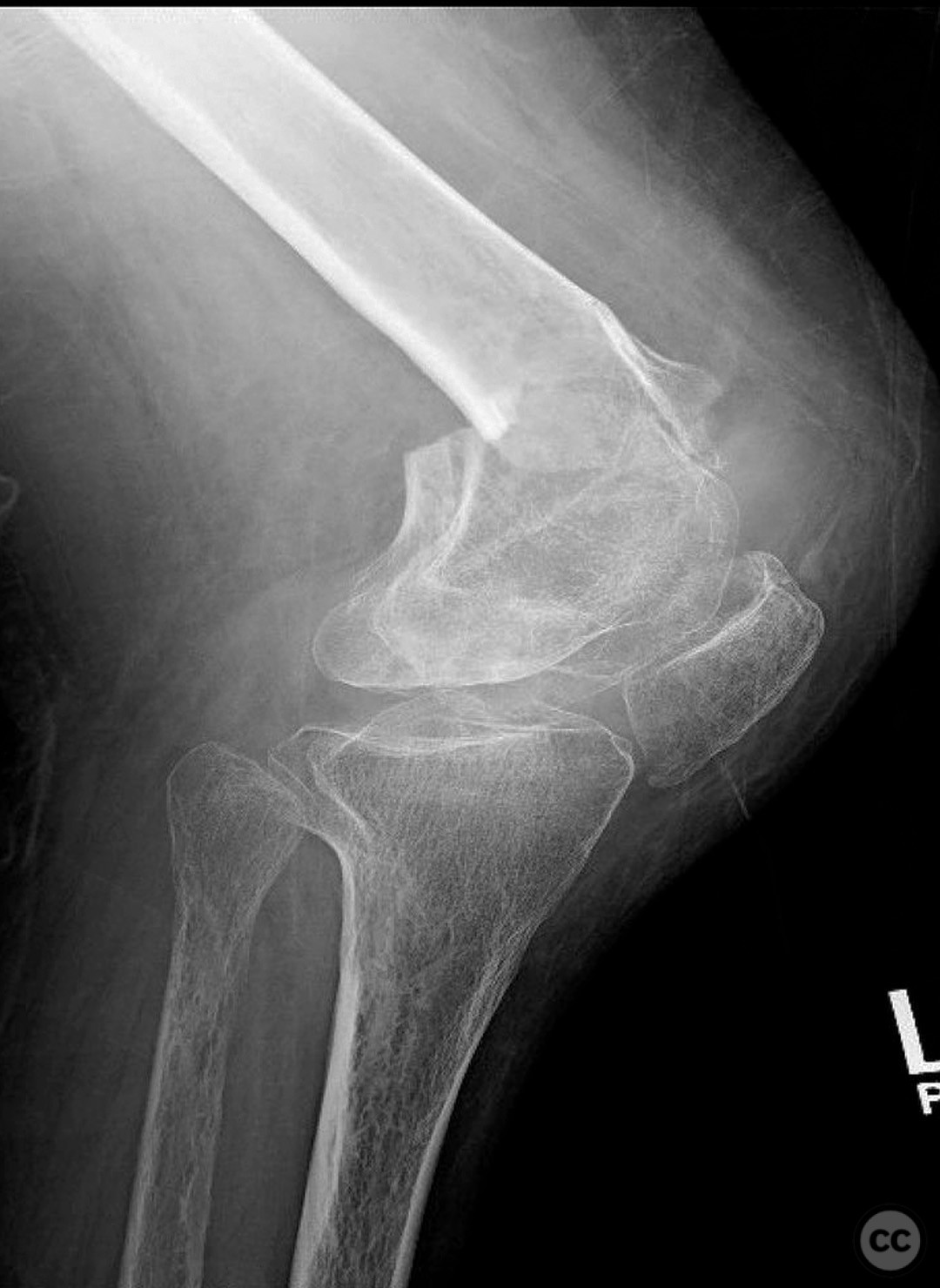 case image