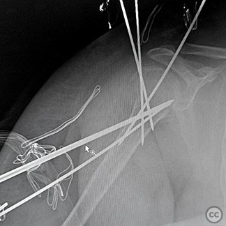 case image