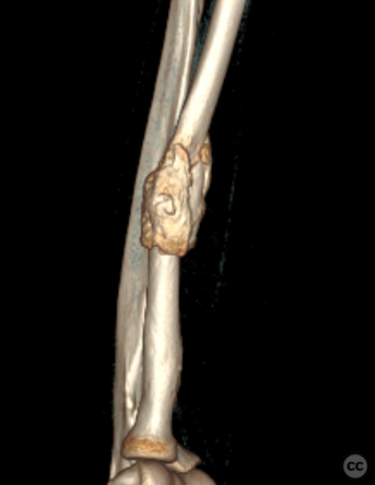 case image