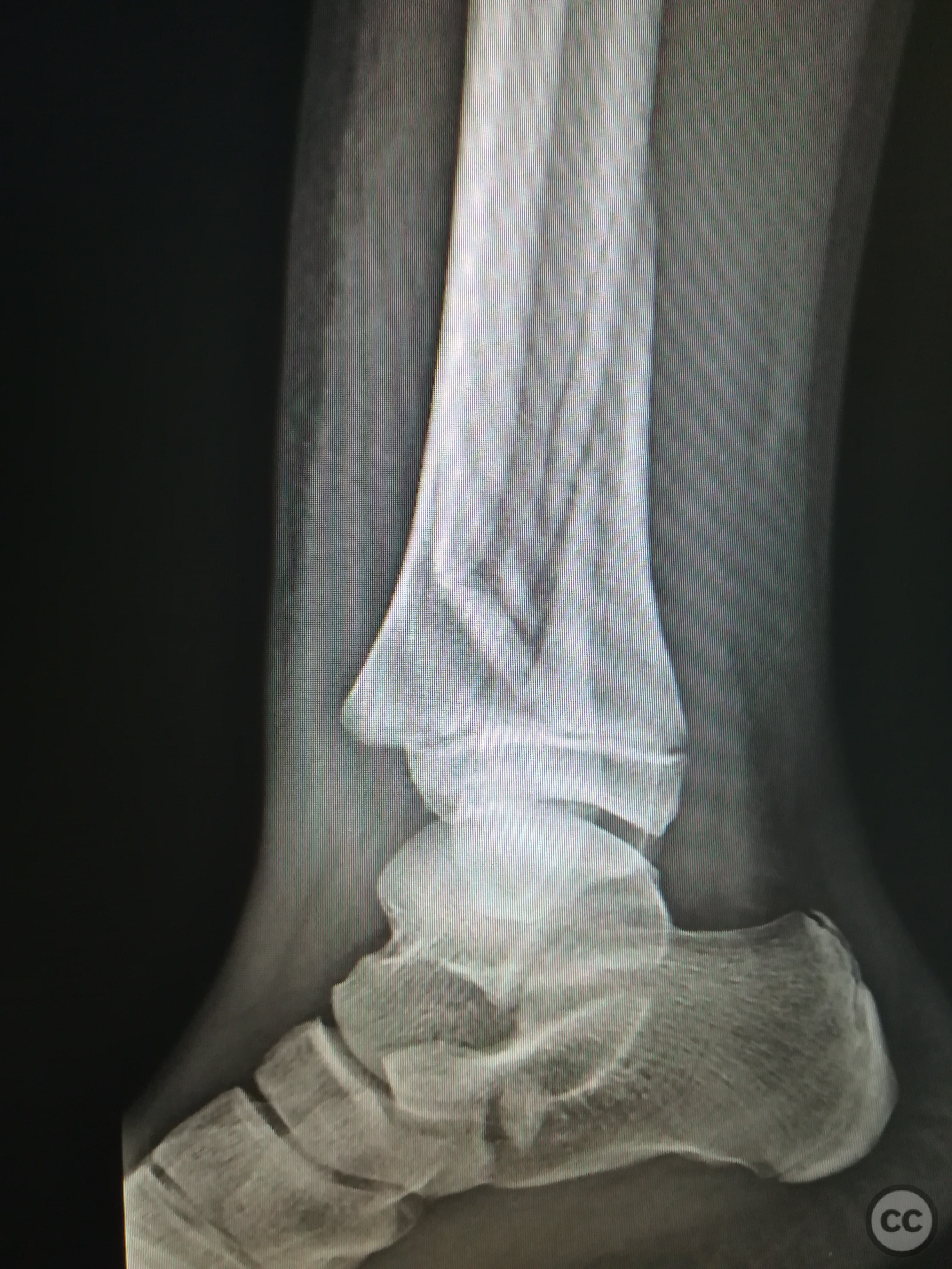 case image