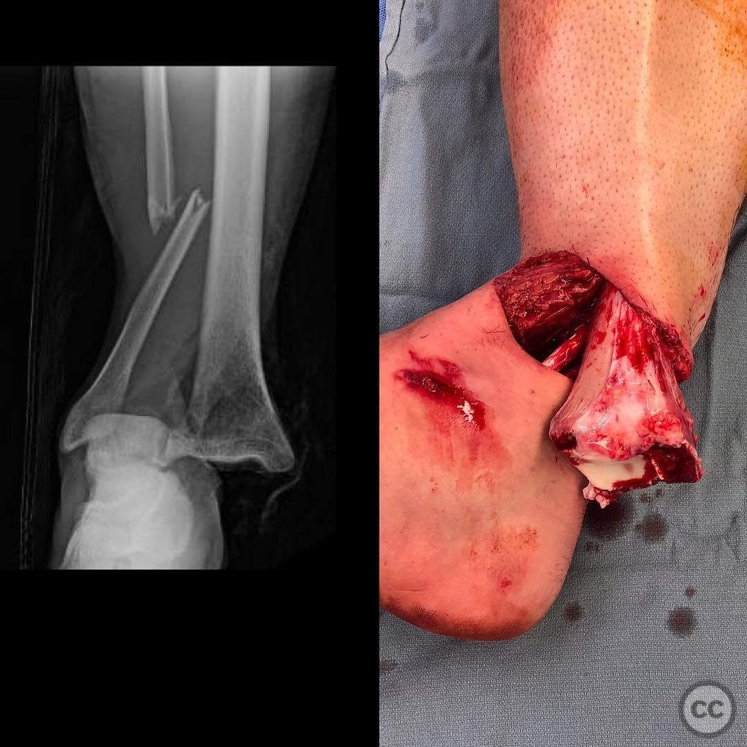 case image