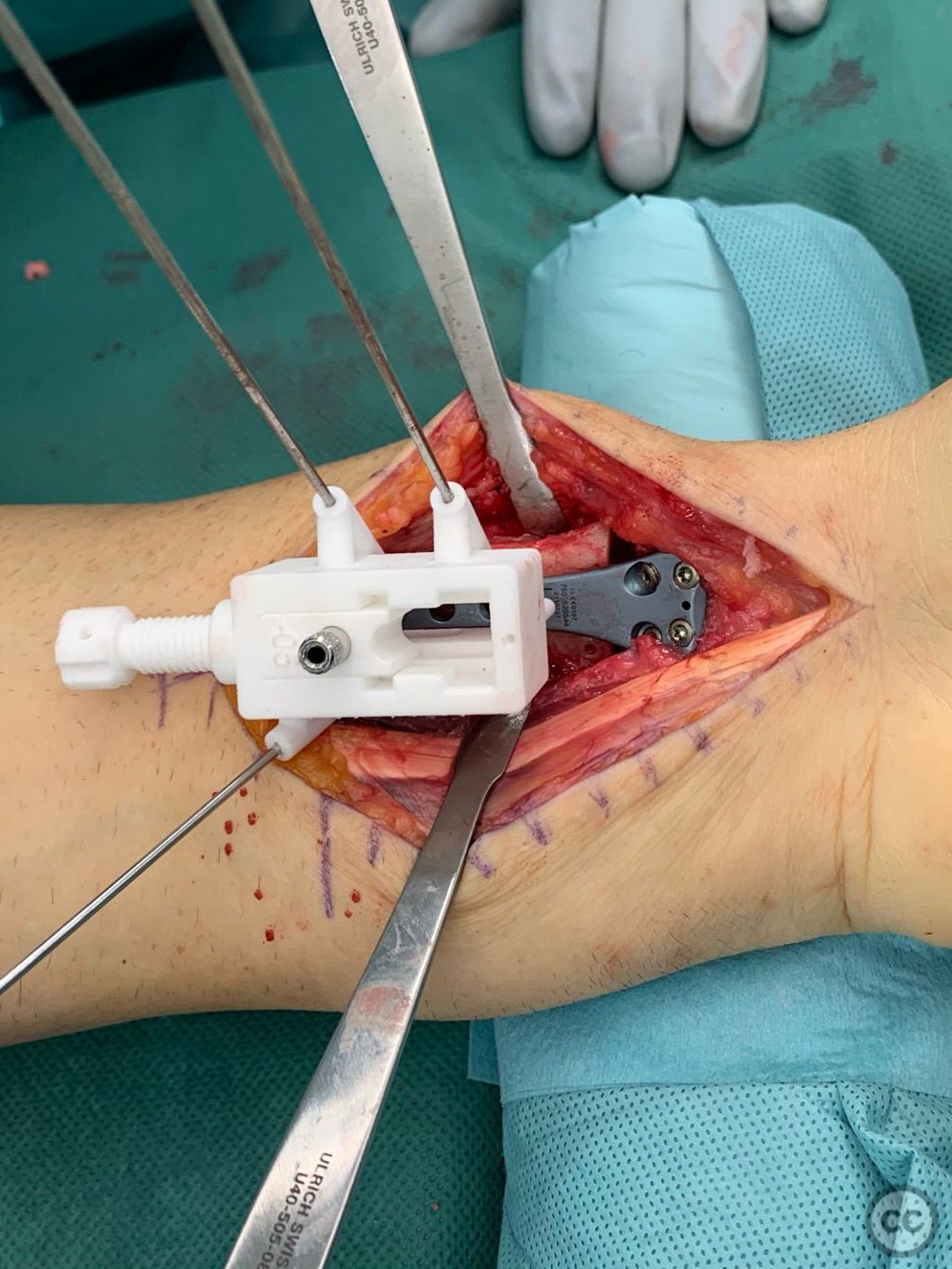 case image