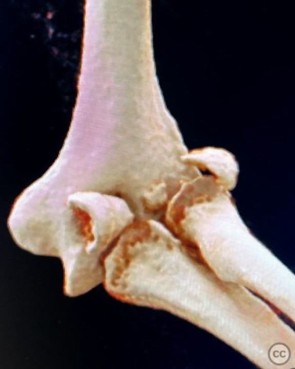 case image