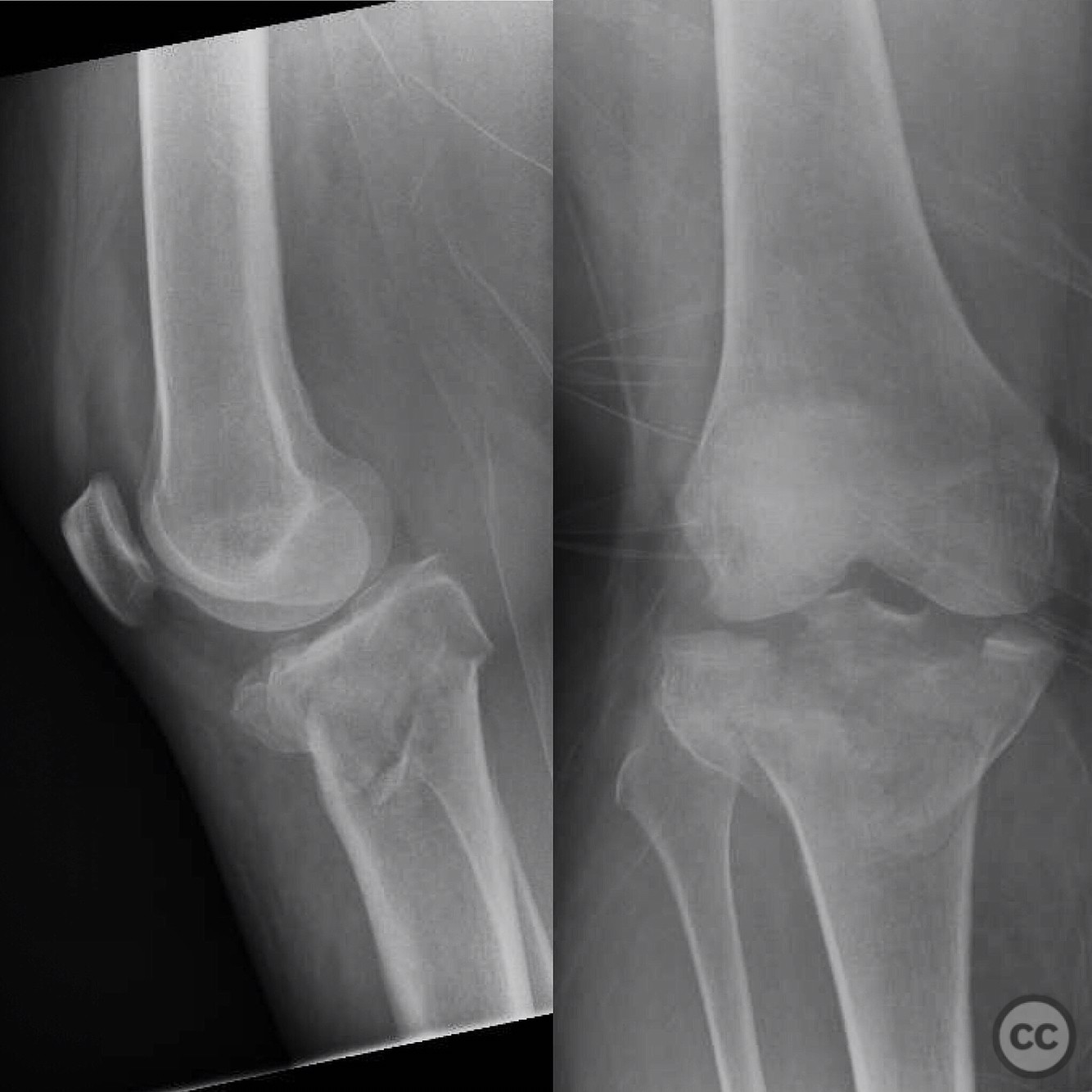 case image