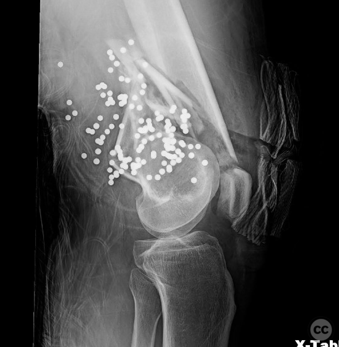 case image