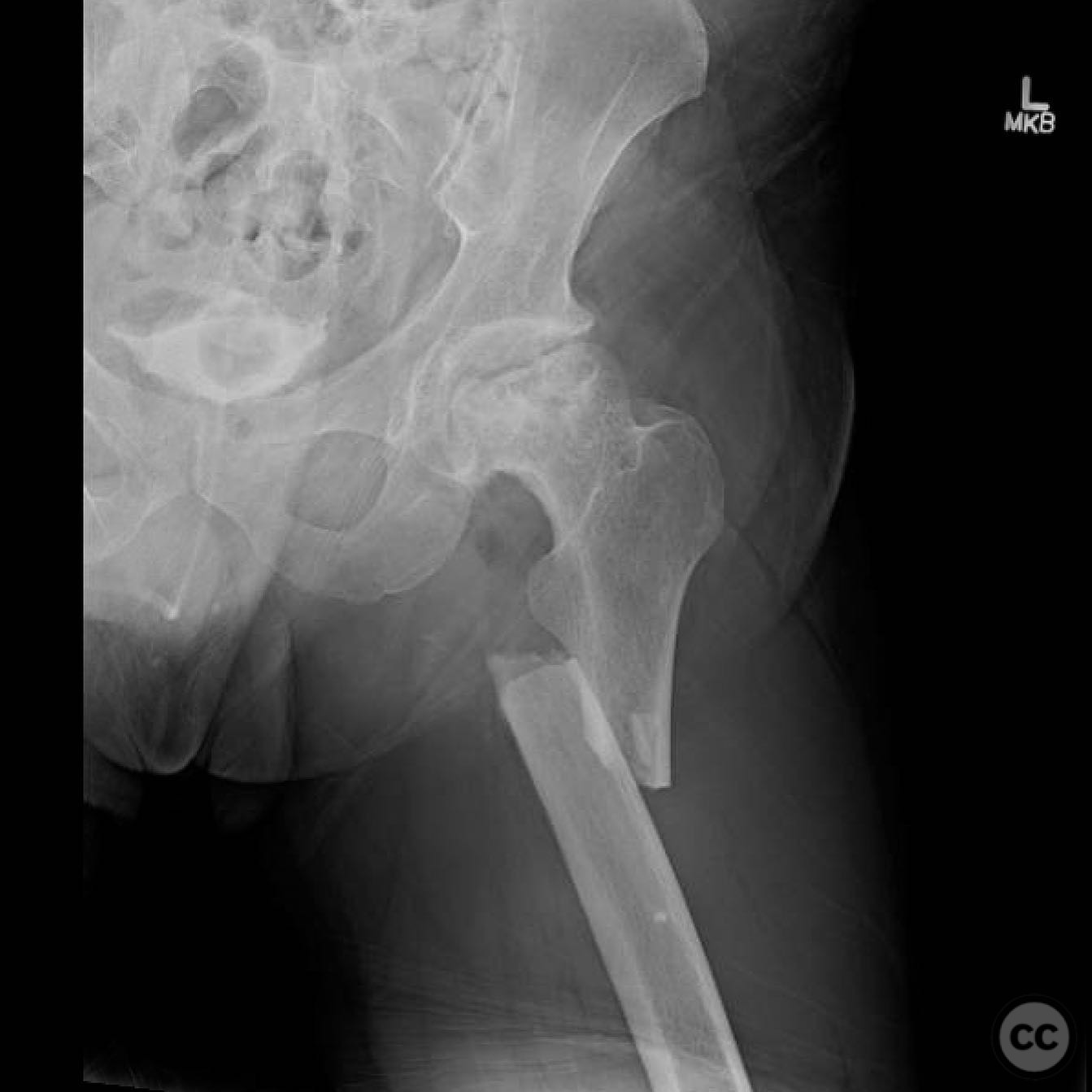 case image