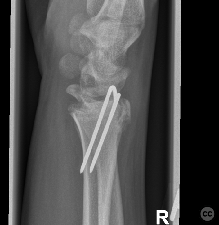 case image