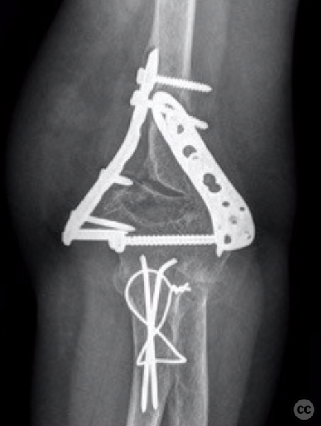case image