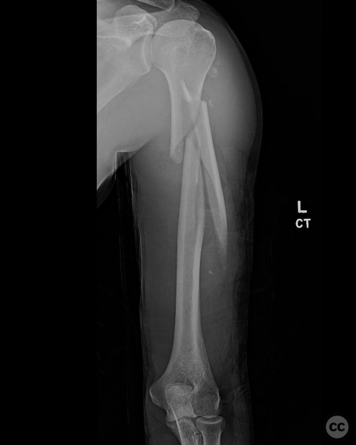 case image