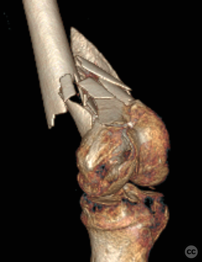 case image