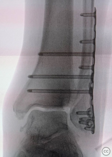 case image