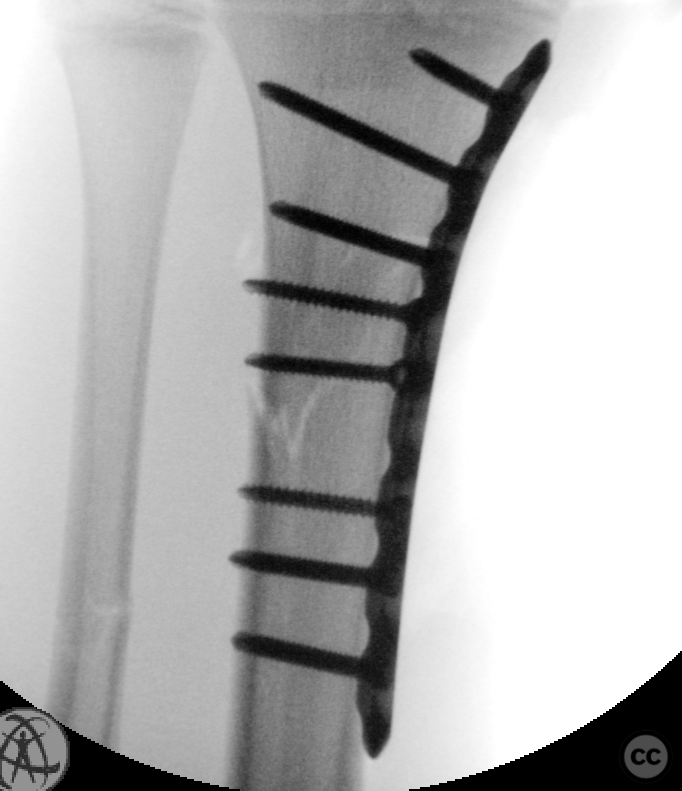 case image