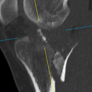 case image
