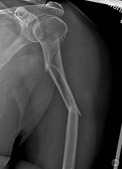case image
