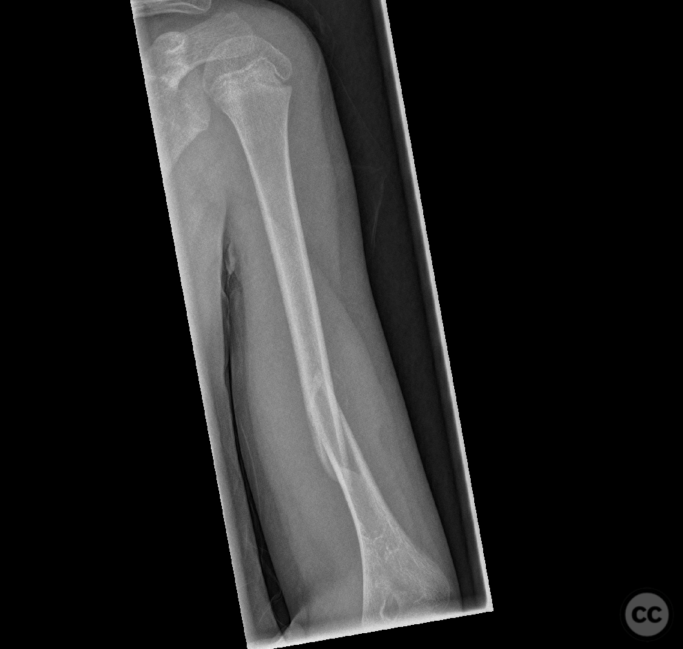 case image