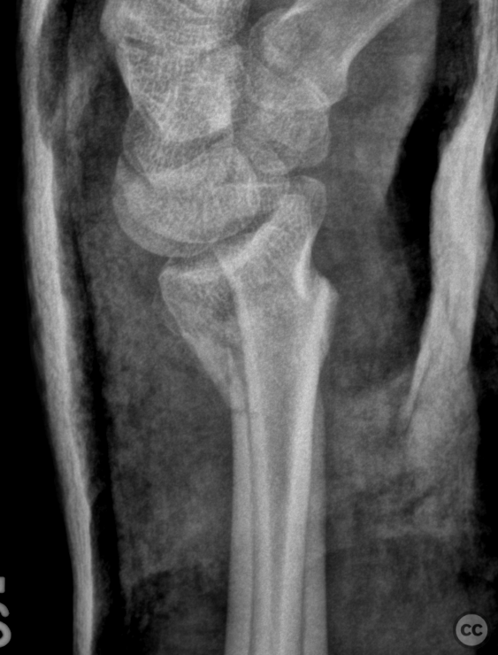 case image