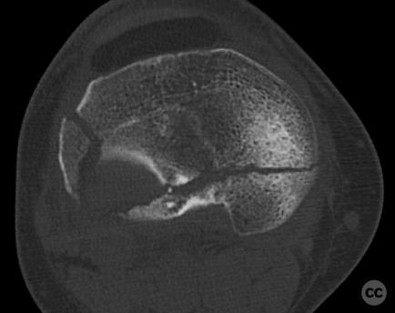 case image