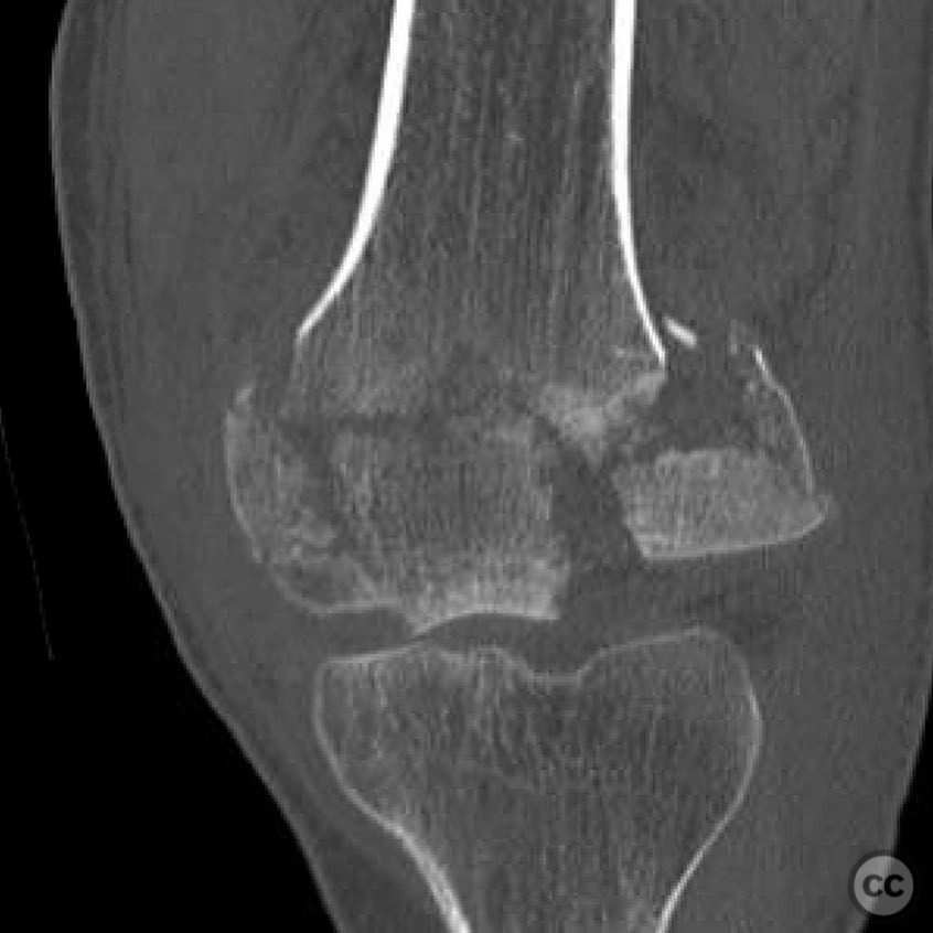 case image