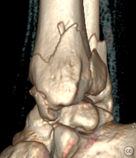 case image