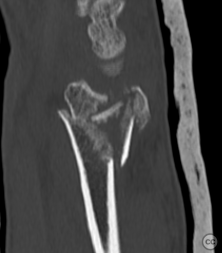case image