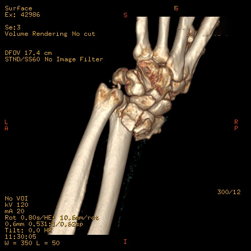 case image