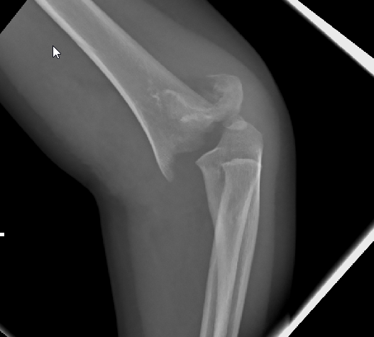 case image
