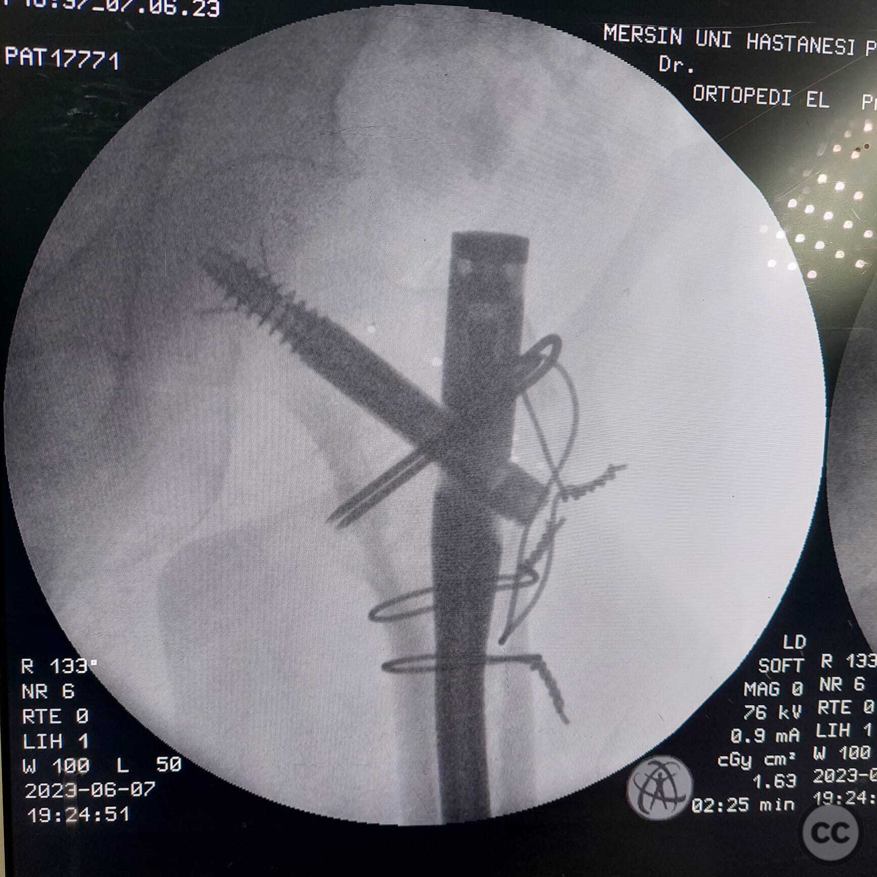 case image