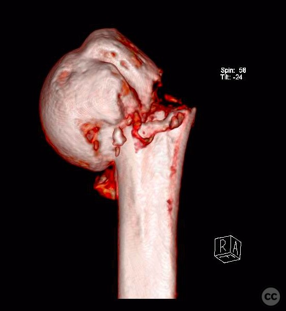 case image