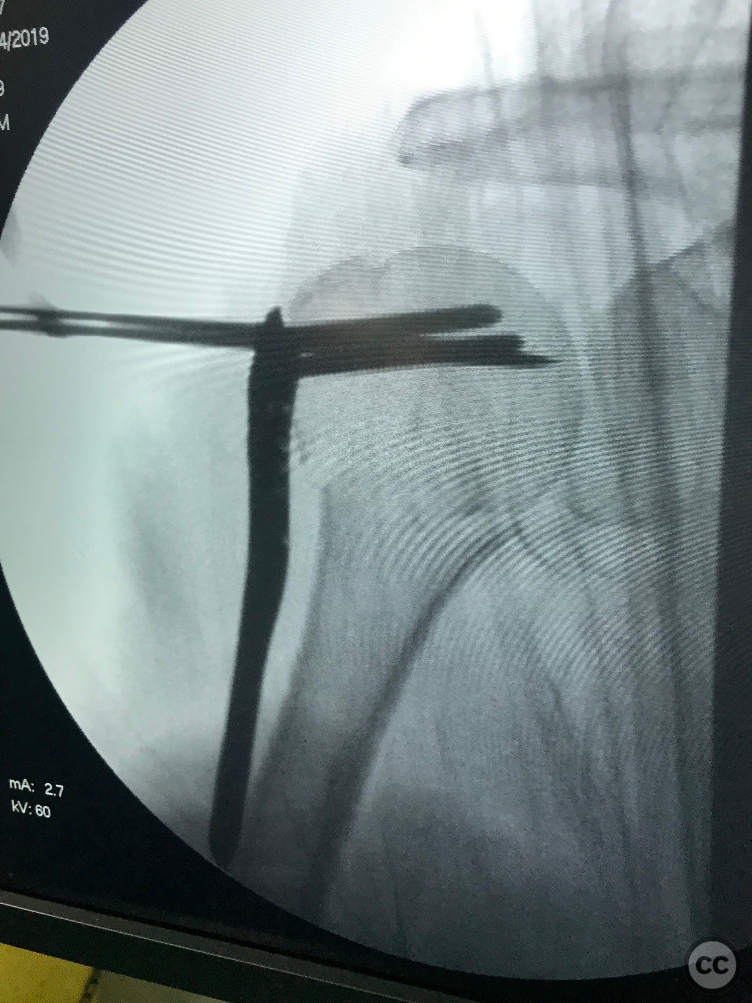 case image