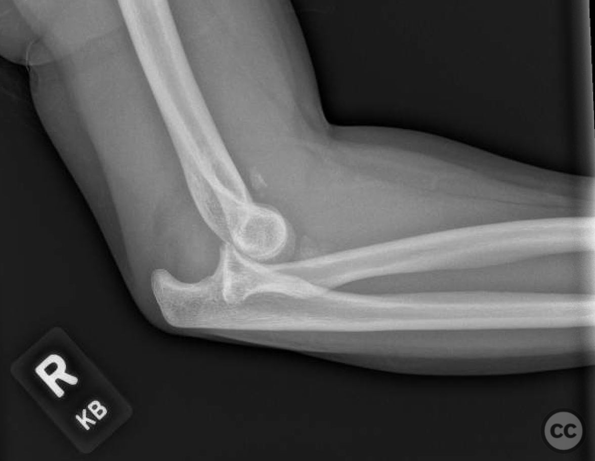 case image