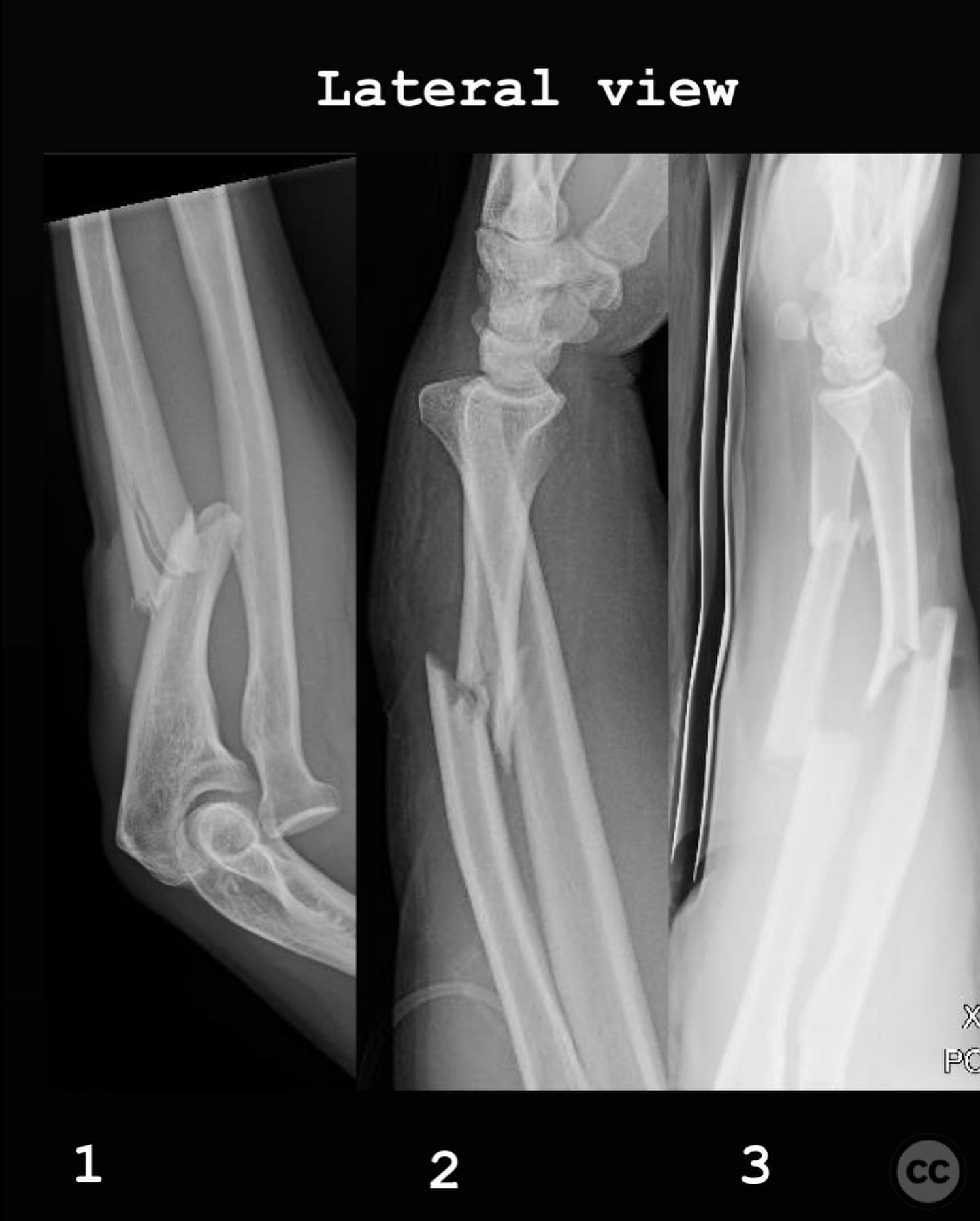 case image