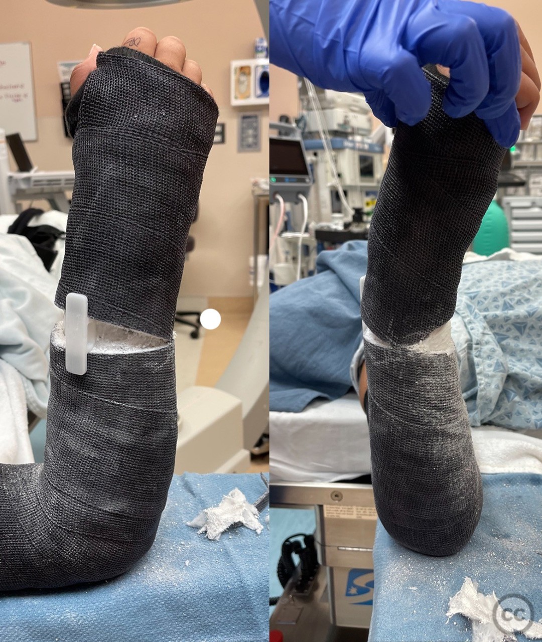 case image
