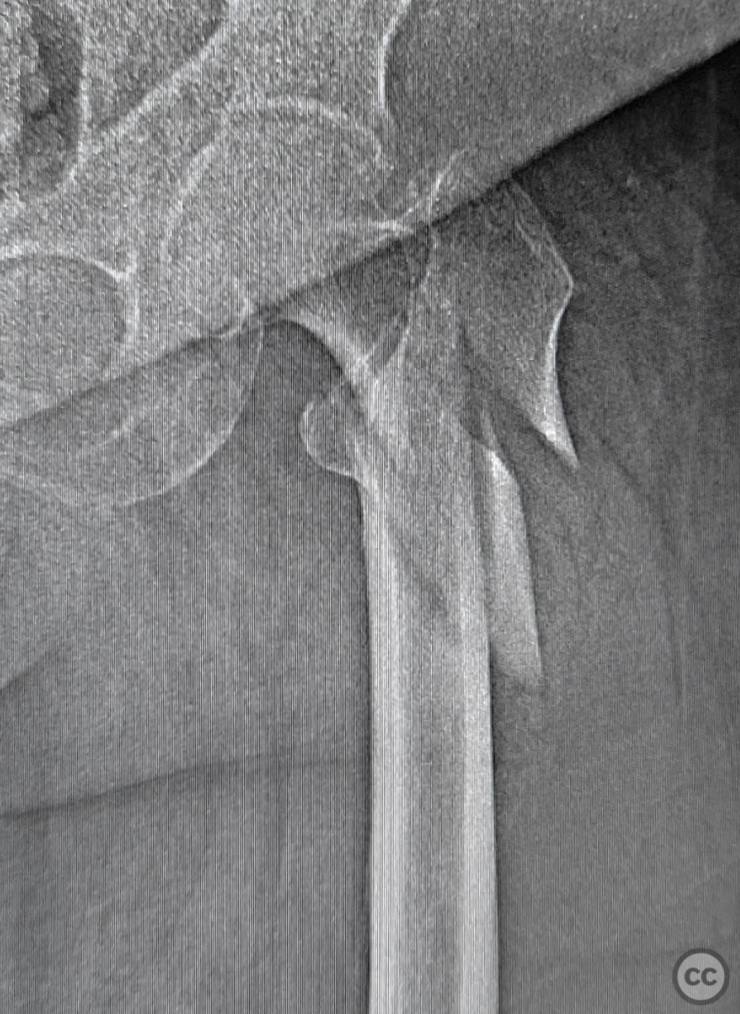 case image