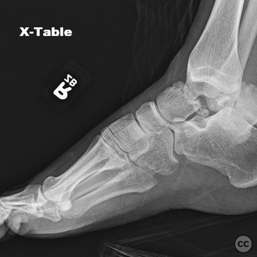 case image