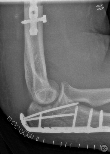 case image