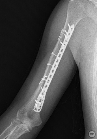 case image