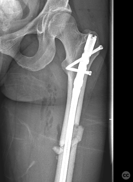 case image