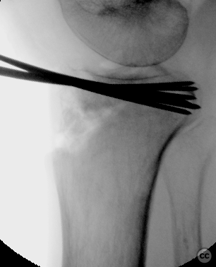 case image
