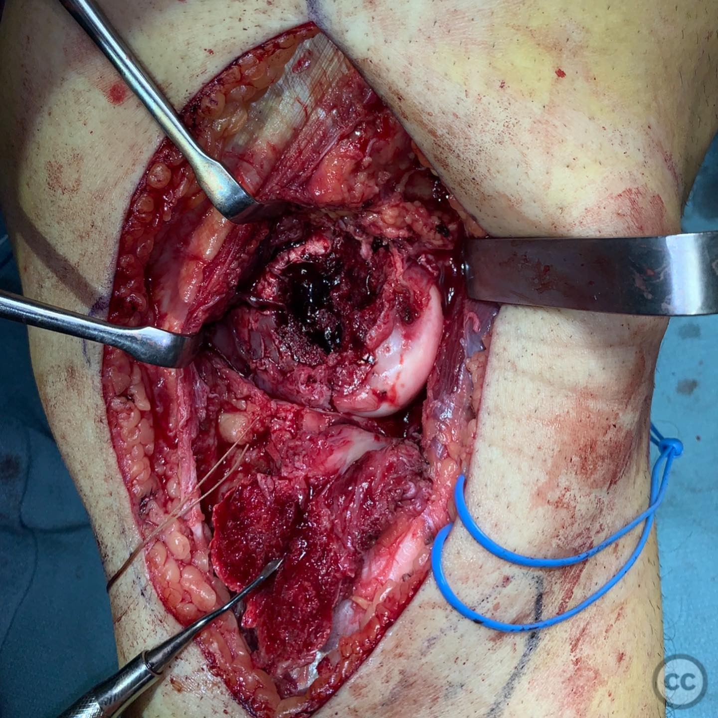 case image