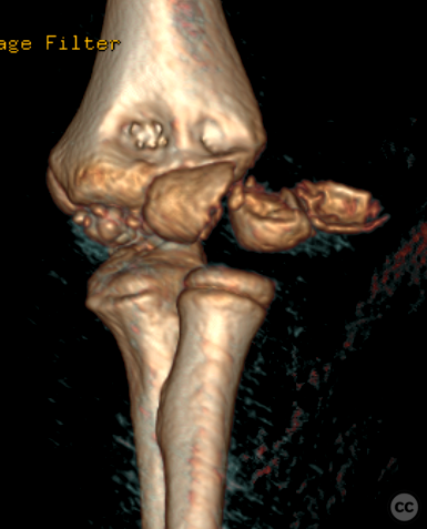 case image