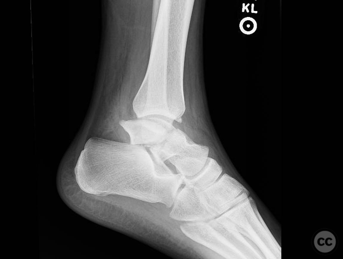 case image