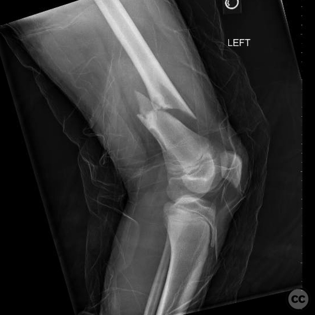 case image