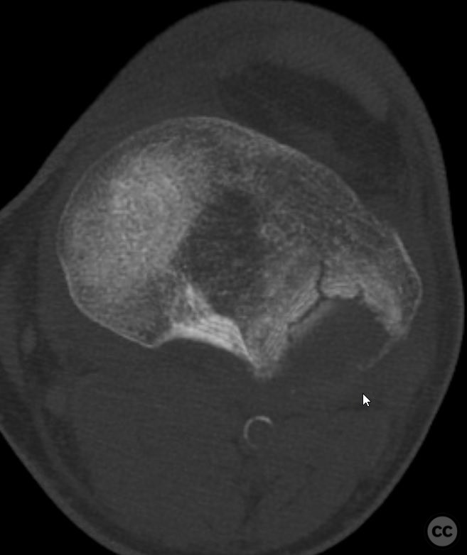 case image