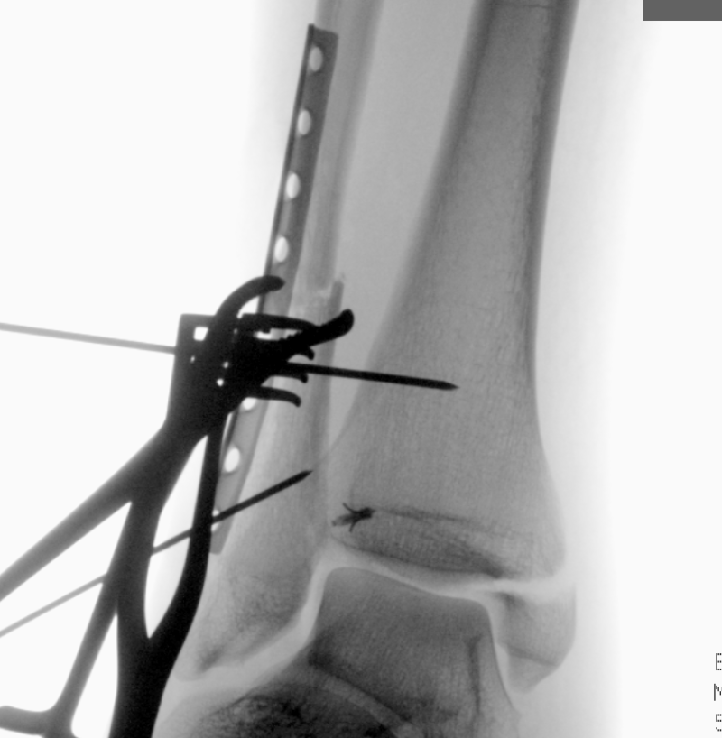 case image