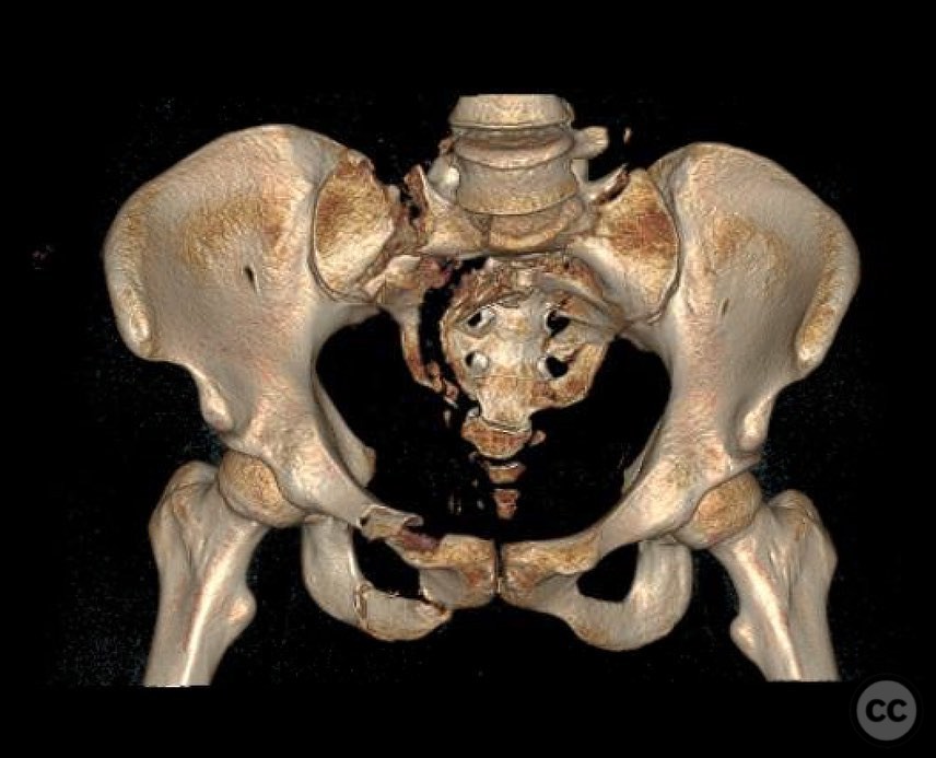 case image
