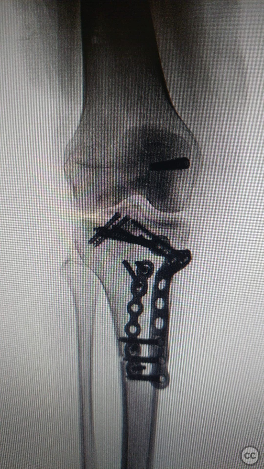 case image